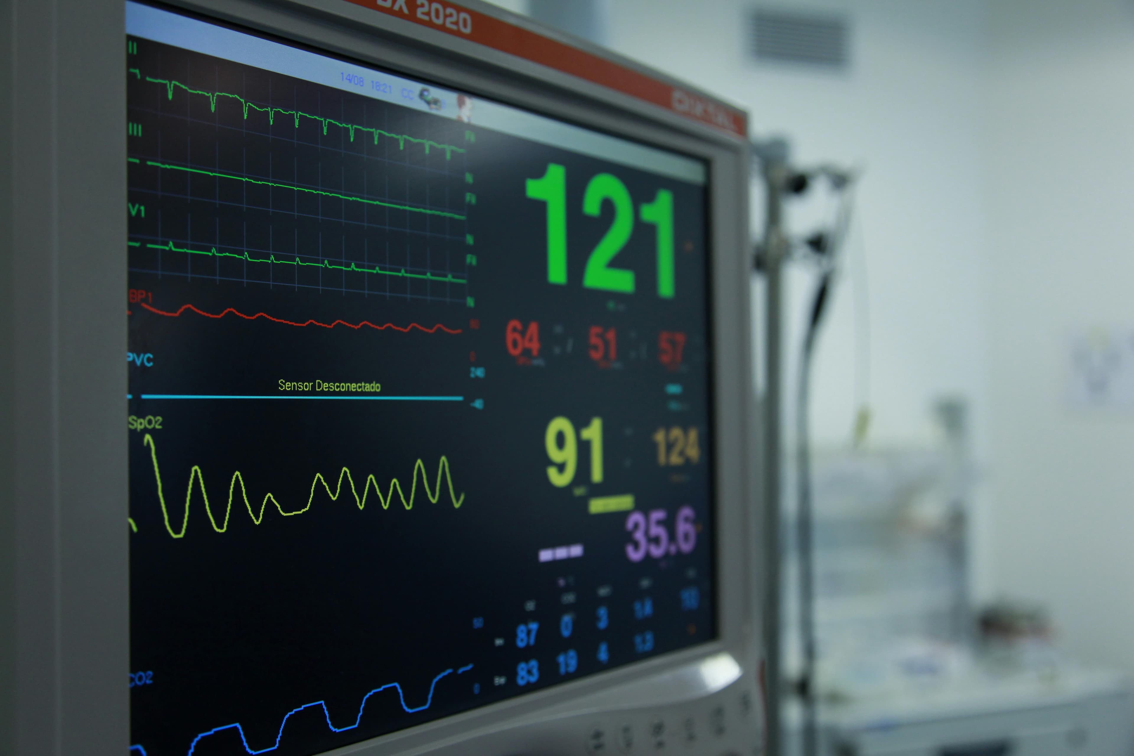 Medical monitoring equipment showing vital signs - professional healthcare technology